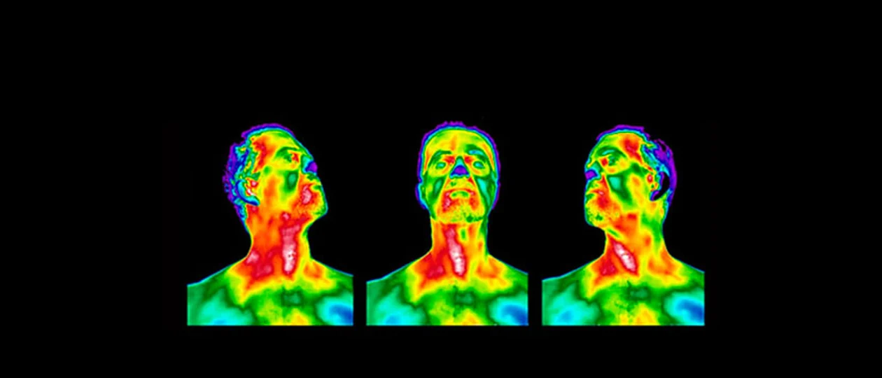 Mapas térmicos de face e pescoço obtidos por termografia infravermelha